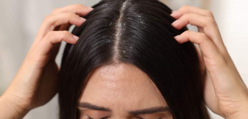 Schuppen Talgdrüsen Hornzellen