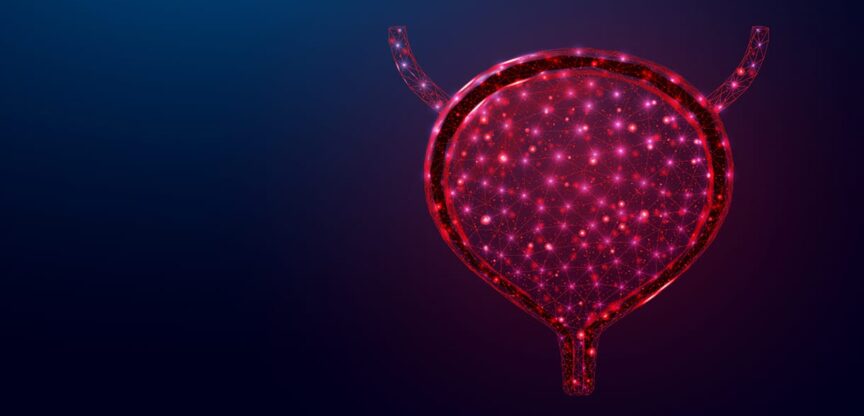 Blase, Nikotinmissbrauch, Blasenkrebs, Blut im Urin