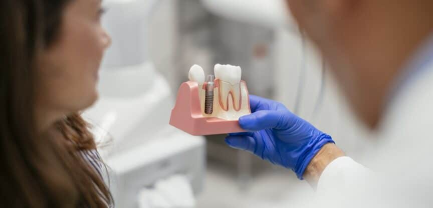 Zähne Zahnmedizin Implantat