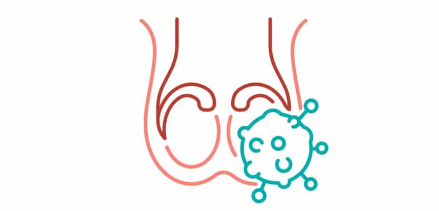 Hodenkrebs, Schnelles Handeln, immer mehr junge Männer betroffen