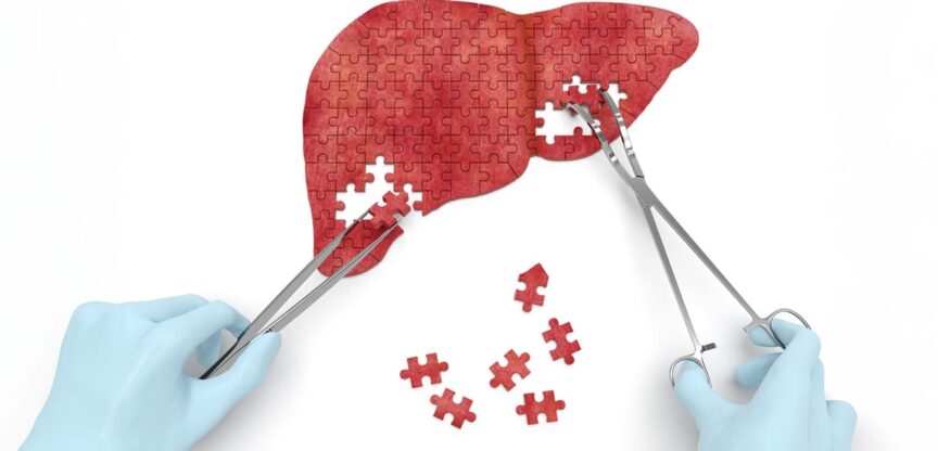 Leber, Hepatitis B, Hepatitis C, Infektionskrankheiten