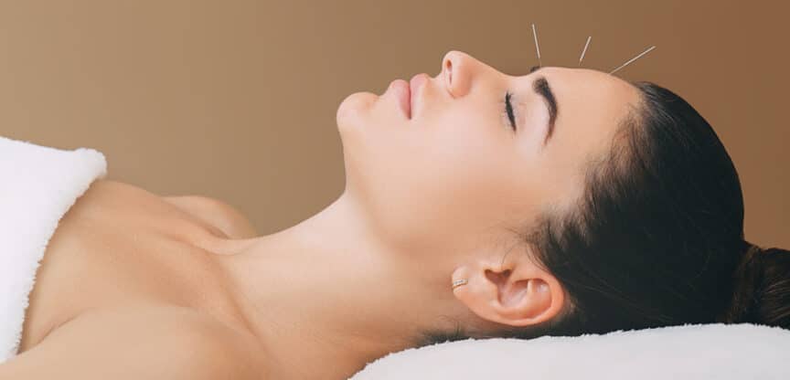 TCM Qi Durchblutung Schönheitsakupunktur