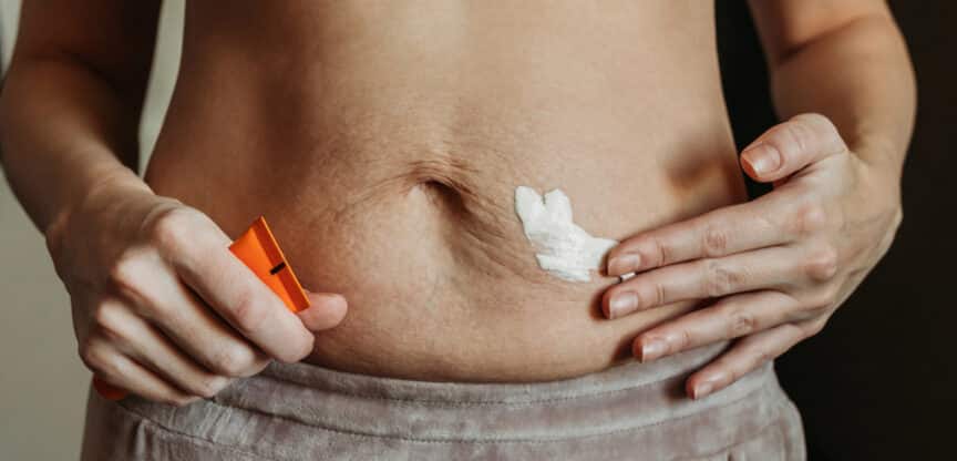 Haut, Gewebe schlaff und schlapp, Dermatologie, Sibylle Wichlas