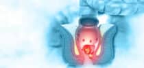 Anal- und Enddarmbereich, Hämorrhoiden, Abszesse, Ekzeme, Fissuren
