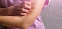 Neurodermitis Hautkrankheit Therapien