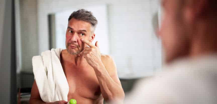 Pflegebedürfnisse im Winter Rückfettend Erfrierungen