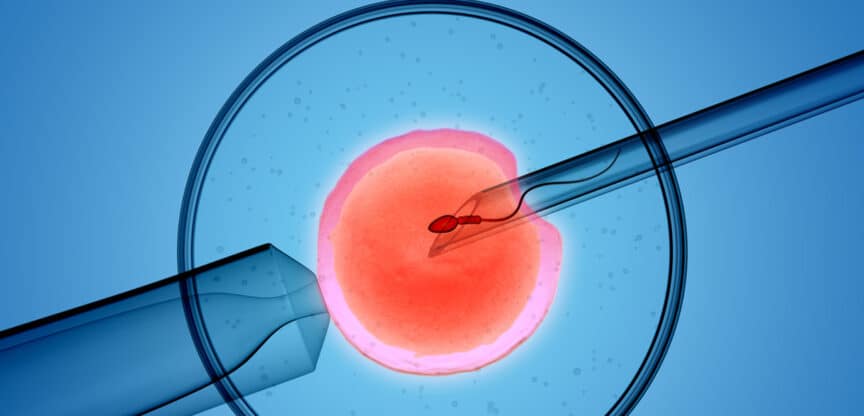 Kinderwunsch, Spermien, Künstliche Befruchtung