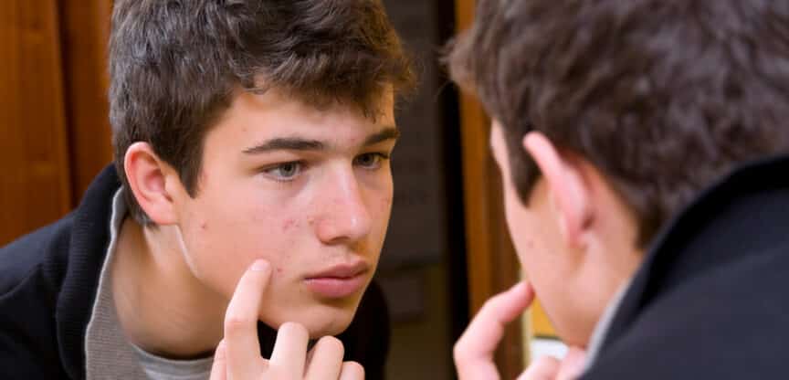 Behandlung Hautunreinheiten Talgdrüsen Hormonhaushalt