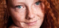 Hautveränderungen Muttermale Sommersprossen Pigmente