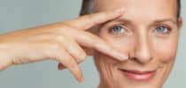 Augenfalten Hängende Lider Botox Hyaluronsäure