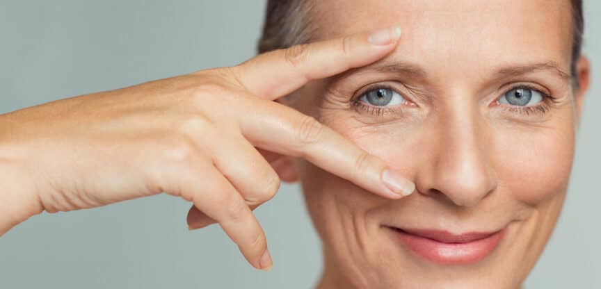 Augenfalten Hängende Lider Botox Hyaluronsäure