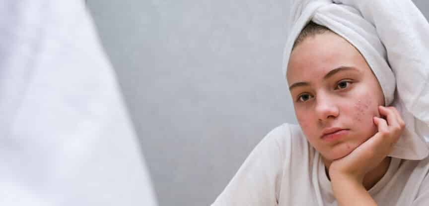 Hautkrankheiten Psychosomatik Seele