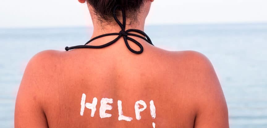 Sonnenschutz UV Strahlen Sonnenallergie