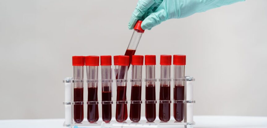 Leber, Gesundheitscheck, Labor, Blut