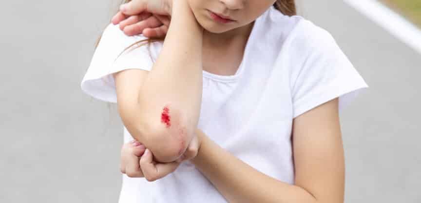 Wundversorgung Schnittwunde Schürfwunde Platzwunde