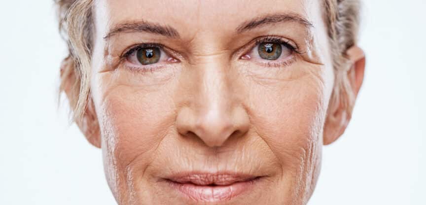 Alterserscheinung Pflege und Behandlung