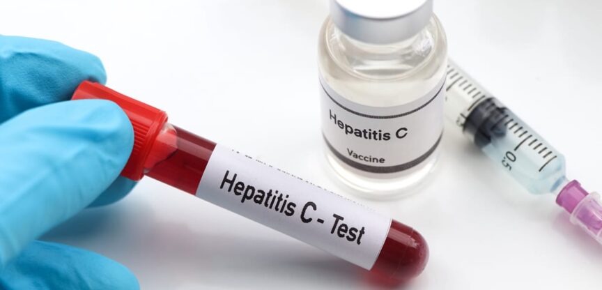 Leber, Hepatitis C, Leberentzuendung, Viren, Leberzirrhose, Leberversagen