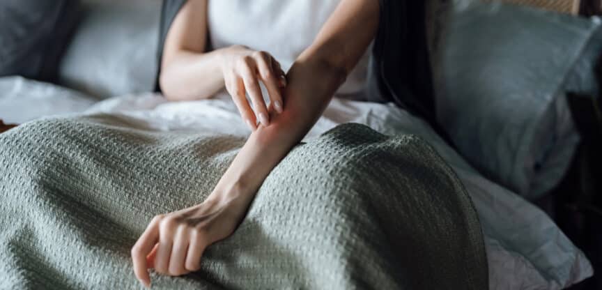 Hautkrankheiten Haarausfall Anti-Stress-Tipps