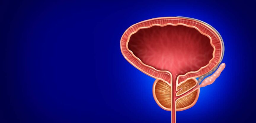 Prostataentzündung, Prostatavergrößerung, Früherkennung
