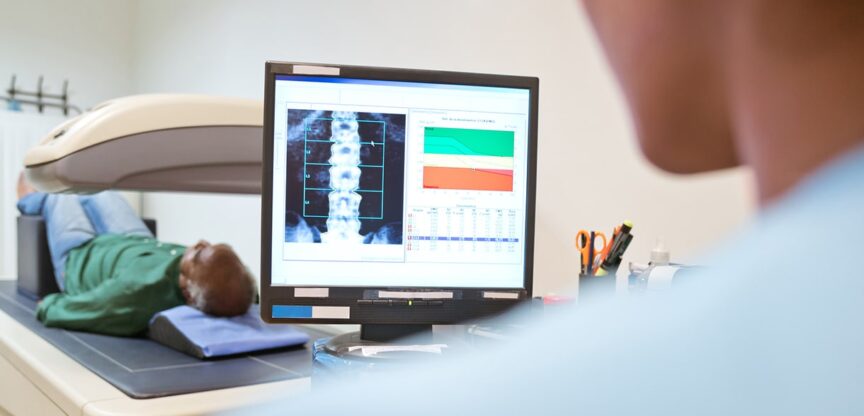 Osteoporose, Knochenschwund, Bewegung, Sport