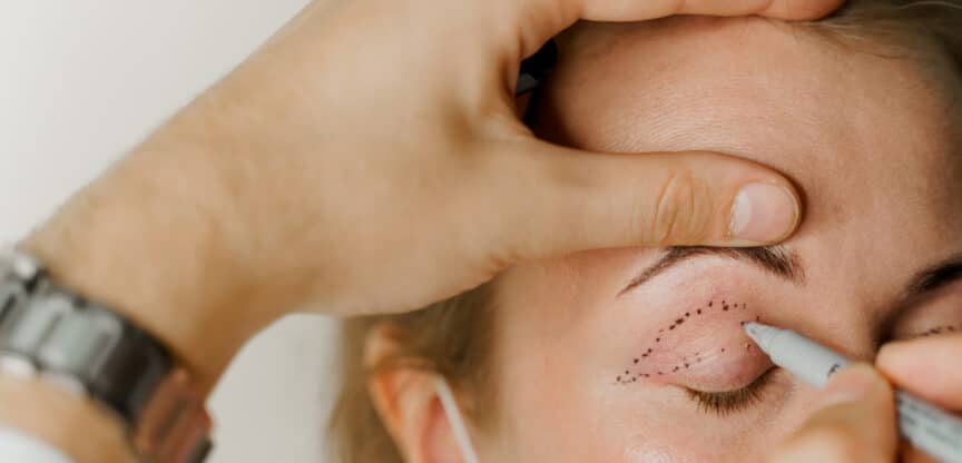 Augenlidstraffung Operation