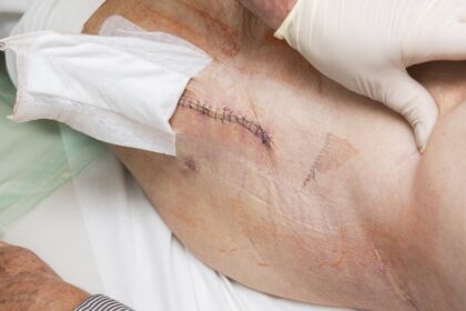 Haut, Wundinfektion, OP, Keime, Operation, Desinfizieren