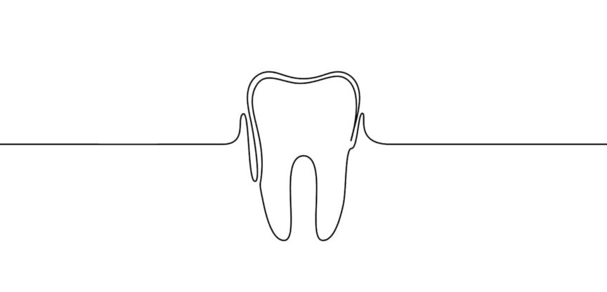 Zahn, Wurzelkanalbehandlung, Wurzelspitzenresektion, Karies