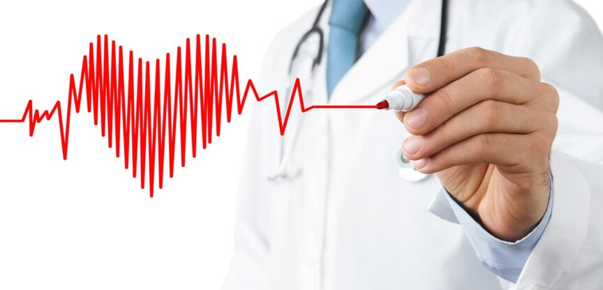 Sinusrhythmus, Herzschlag, Bluthochdruck, Herzklappenerkrankungen