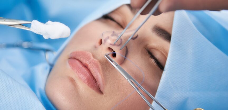 Chirurgische Instrumente an der Nase einer jungen Frau, die mit geschlossenen Augen am OP-Tisch liegt.