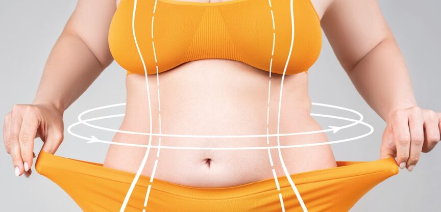 Übergewichtige Frau zieht Saum ihres gelben Bikinihöschens in die Breite.