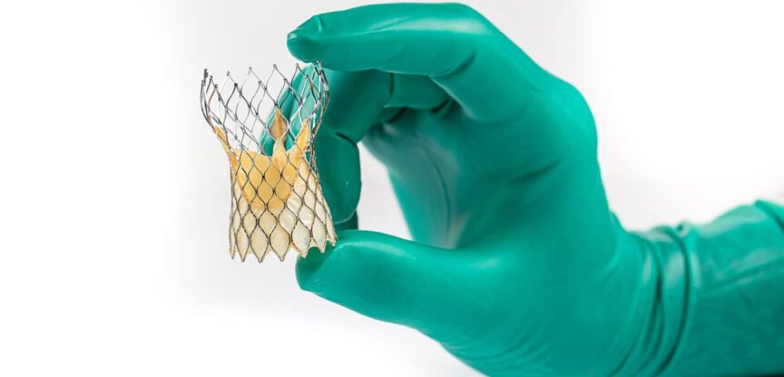 Minimalinvasiver Herzklappenersatz