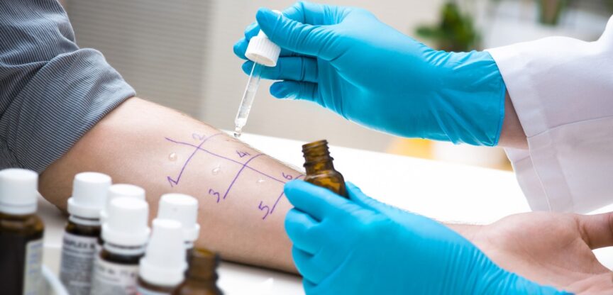 Allergietest