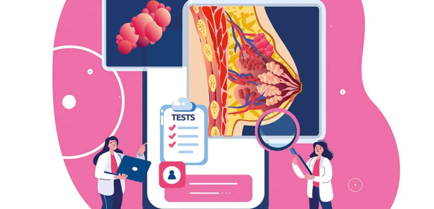 Zwei Ärztinnen analysieren medizinische Darstellungen einer weiblichen Brust mit Organstruktur und Testauswertung auf einem großen Bildschirm.