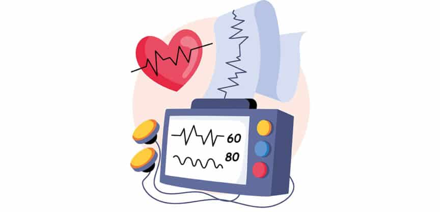 Illustration eines Herzmonitors mit Herzsymbol und EKG-Kurven, die auf einem Display und einem Ausdruck dargestellt sind – Symbol für Herzfrequenzüberwachung.