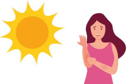 Illustration einer Frau mit Sonnenallergie
