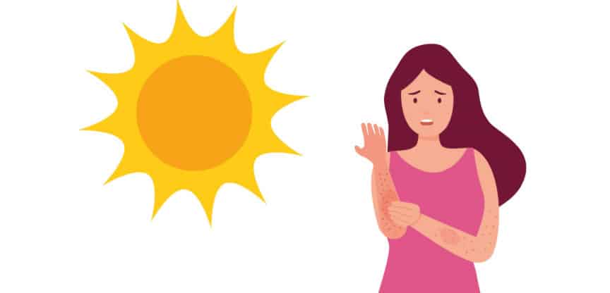 Illustration einer Frau mit Sonnenallergie