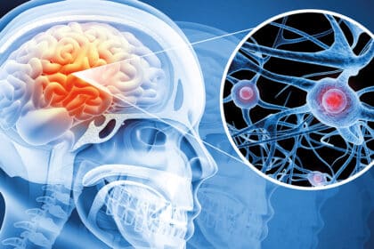 Medizinische Illustration eines Gehirns im Schädel mit hervorgehobenen Nervenzellen und neuronalen Verbindungen im Detail.