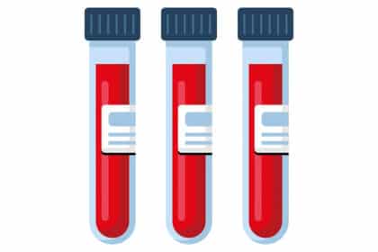 Illustration von drei Reagenzgläsern mit roter Flüssigkeit, symbolisch für Blutproben im Labor.