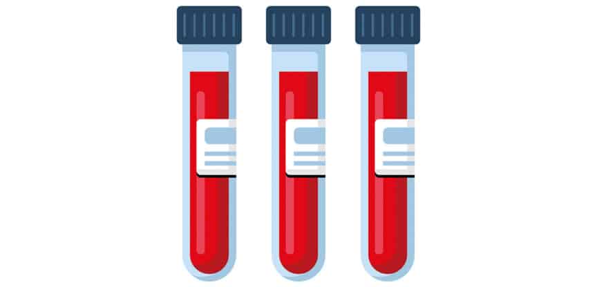 Illustration von drei Reagenzgläsern mit roter Flüssigkeit, symbolisch für Blutproben im Labor.