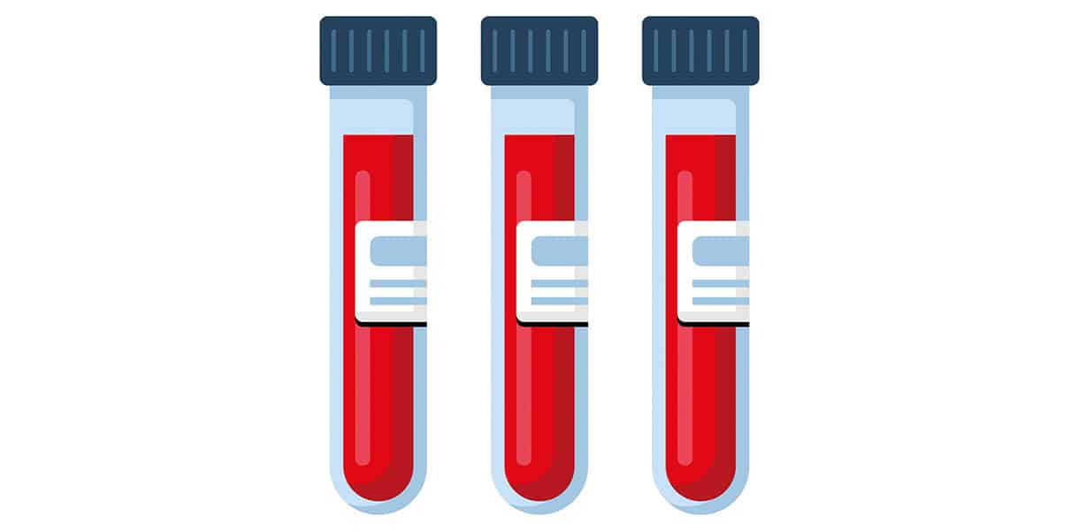 Illustration von drei Reagenzgläsern mit roter Flüssigkeit, symbolisch für Blutproben im Labor.