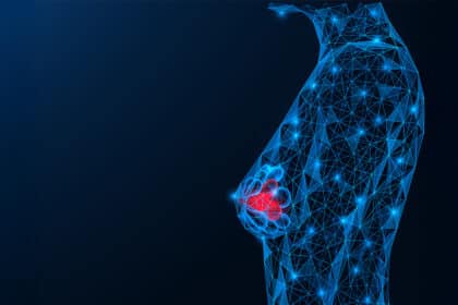 Digitale Illustration einer Brust mit rotem Bereich, symbolisch für Tumor oder Krebs.