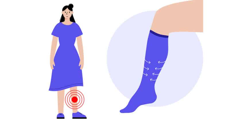 Detaildarstellung eines Beins mit Kompressionsstrumpf, der den Druckverlauf durch Pfeile zeigt.