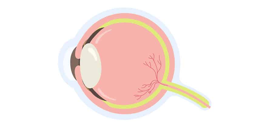 Illustration eines menschlichen Auges im Querschnitt, mit sichtbarer Linse, Netzhaut und Sehnerv.