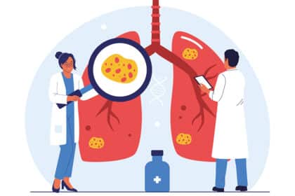 Illustration zweier Ärzt:innen, die erkrankte Lungen untersuchen; Lupe zeigt auffällige gelbe Flecken in der Lunge.