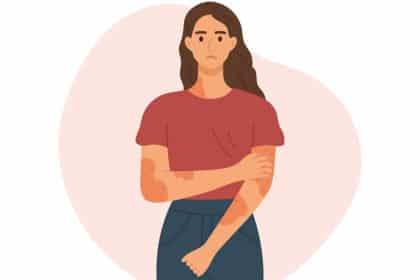 Illustration einer Frau mit sichtbarem Hautausschlag an Armen und Hals.