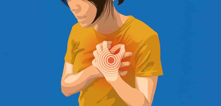 Illustration einer Frau, die sich mit beiden Händen an die Brust fasst, rotes Zielsymbol zeigt starke Brustschmerzen.