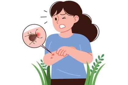 Illustration einer Frau mit geröteter Hautstelle am Arm; eine Lupe zeigt eine Zecke als Ursache.