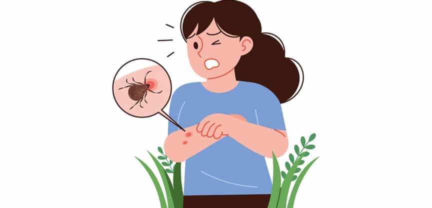 Illustration einer Frau mit geröteter Hautstelle am Arm; eine Lupe zeigt eine Zecke als Ursache.