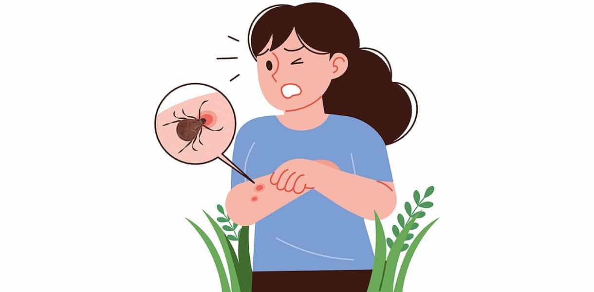 Illustration einer Frau mit geröteter Hautstelle am Arm; eine Lupe zeigt eine Zecke als Ursache.