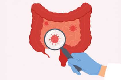 Illustration eines Darms, in dem mit einer Lupe entzündliche oder schädliche Strukturen hervorgehoben werden.